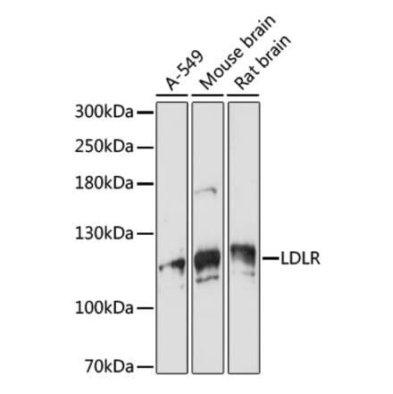 Western Blot - Anti-VPS18 Antibody (A93144) - Antibodies.com