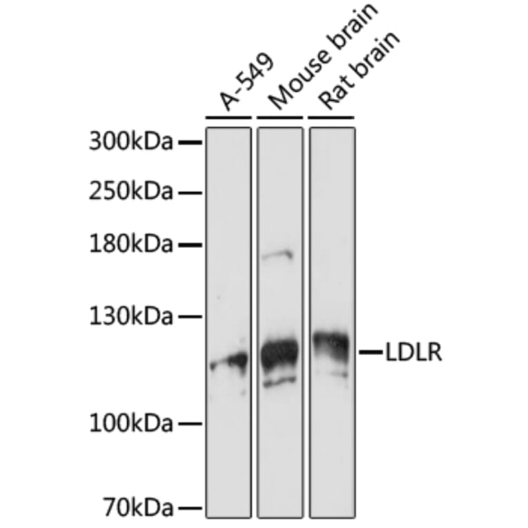 Western Blot - Anti-VPS18 Antibody (A93144) - Antibodies.com
