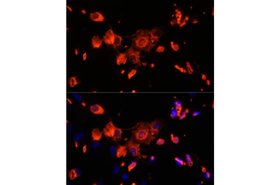 Immunofluorescence - Anti-VPS18 Antibody (A93144) - Antibodies.com