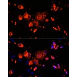 Immunofluorescence - Anti-VPS18 Antibody (A93144) - Antibodies.com