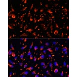 Immunofluorescence - Anti-VPS18 Antibody (A93144) - Antibodies.com