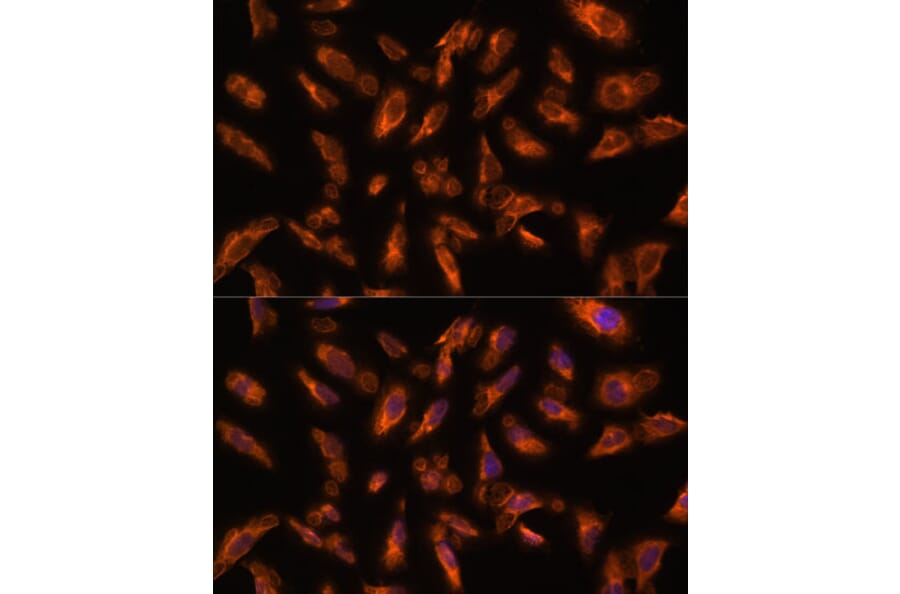 Immunofluorescence - Anti-VPS18 Antibody (A93144) - Antibodies.com
