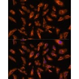 Immunofluorescence - Anti-VPS18 Antibody (A93144) - Antibodies.com
