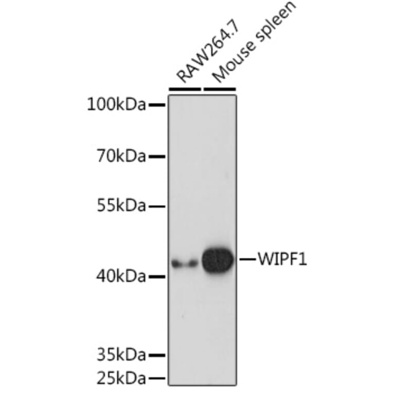 Western Blot - Anti-WIPF1 Antibody (A93146) - Antibodies.com