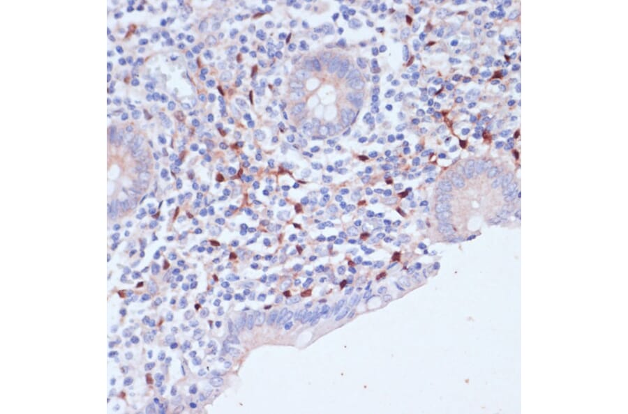 Immunohistochemistry - Anti-WIPF1 Antibody (A93146) - Antibodies.com