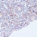 Immunohistochemistry - Anti-WIPF1 Antibody (A93146) - Antibodies.com