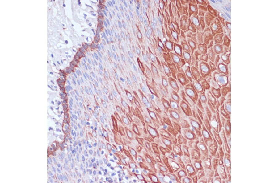Immunohistochemistry - Anti-WIPF1 Antibody (A93146) - Antibodies.com