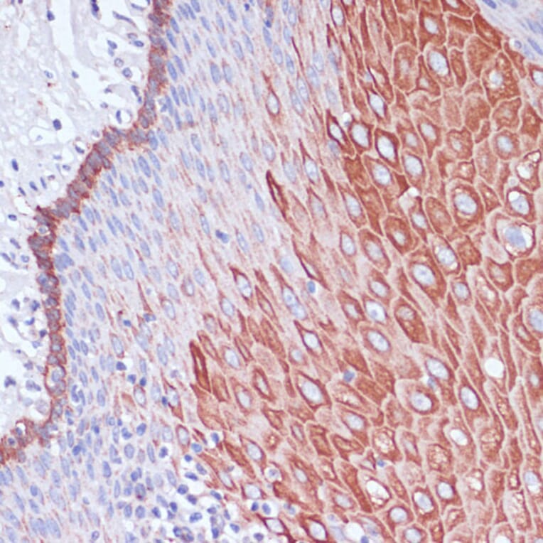 Immunohistochemistry - Anti-WIPF1 Antibody (A93146) - Antibodies.com