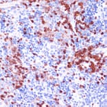 Immunohistochemistry - Anti-WIPF1 Antibody (A93146) - Antibodies.com