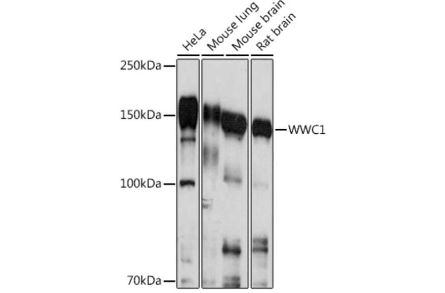 Western Blot - Anti-KIBRA Antibody (A93147) - Antibodies.com