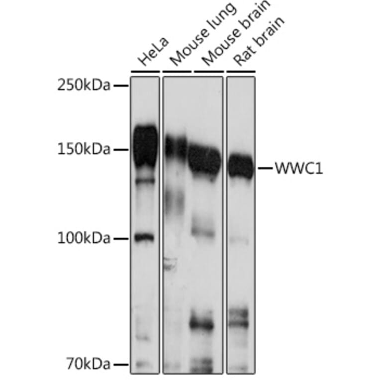 Western Blot - Anti-KIBRA Antibody (A93147) - Antibodies.com