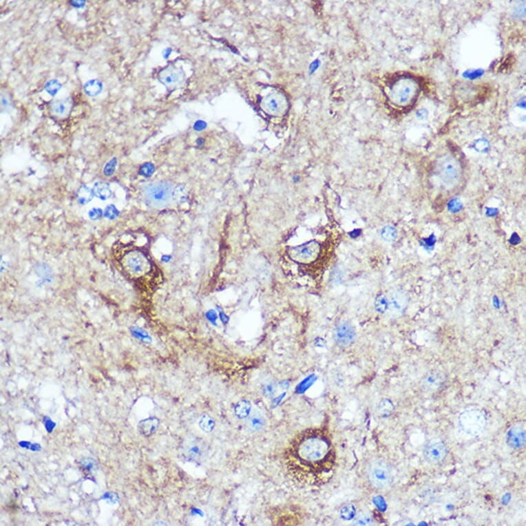 Immunohistochemistry - Anti-KIBRA Antibody (A93147) - Antibodies.com