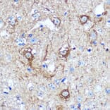 Immunohistochemistry - Anti-KIBRA Antibody (A93147) - Antibodies.com