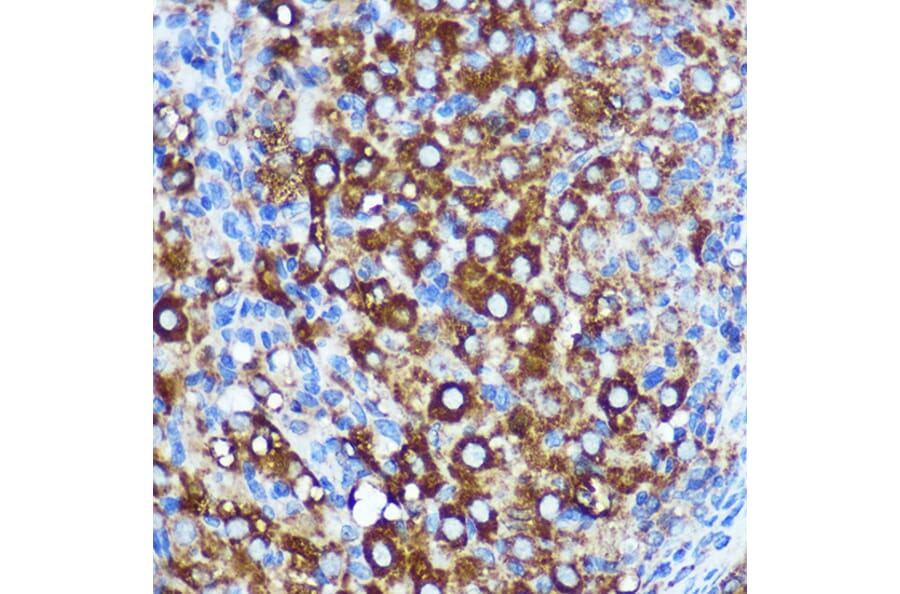 Immunohistochemistry - Anti-KIBRA Antibody (A93147) - Antibodies.com