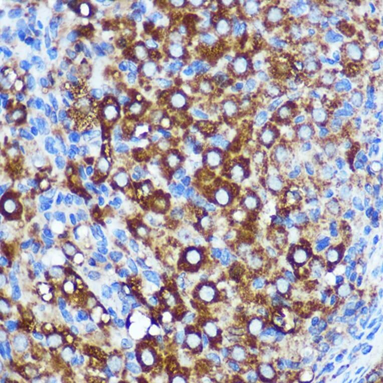 Immunohistochemistry - Anti-KIBRA Antibody (A93147) - Antibodies.com