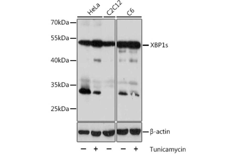 Western Blot - Anti-XBP1 Antibody (A93148) - Antibodies.com