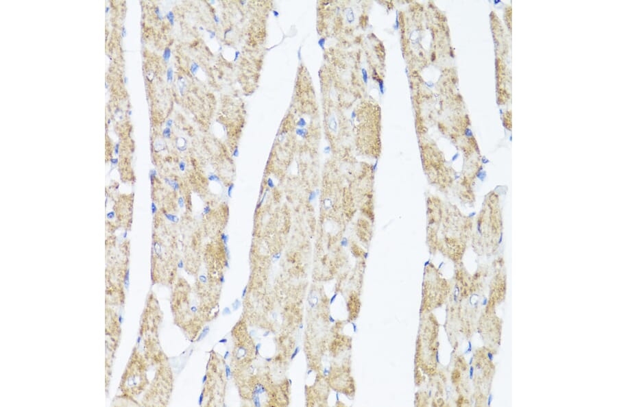 Immunohistochemistry - Anti-XBP1 Antibody (A93148) - Antibodies.com
