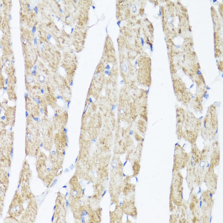 Immunohistochemistry - Anti-XBP1 Antibody (A93148) - Antibodies.com