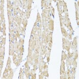 Immunohistochemistry - Anti-XBP1 Antibody (A93148) - Antibodies.com