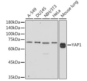 Western Blot - Anti-YAP1 Antibody (A93149) - Antibodies.com