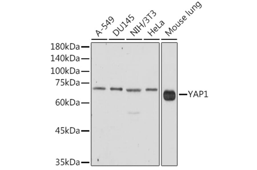 Western Blot - Anti-YAP1 Antibody (A93149) - Antibodies.com