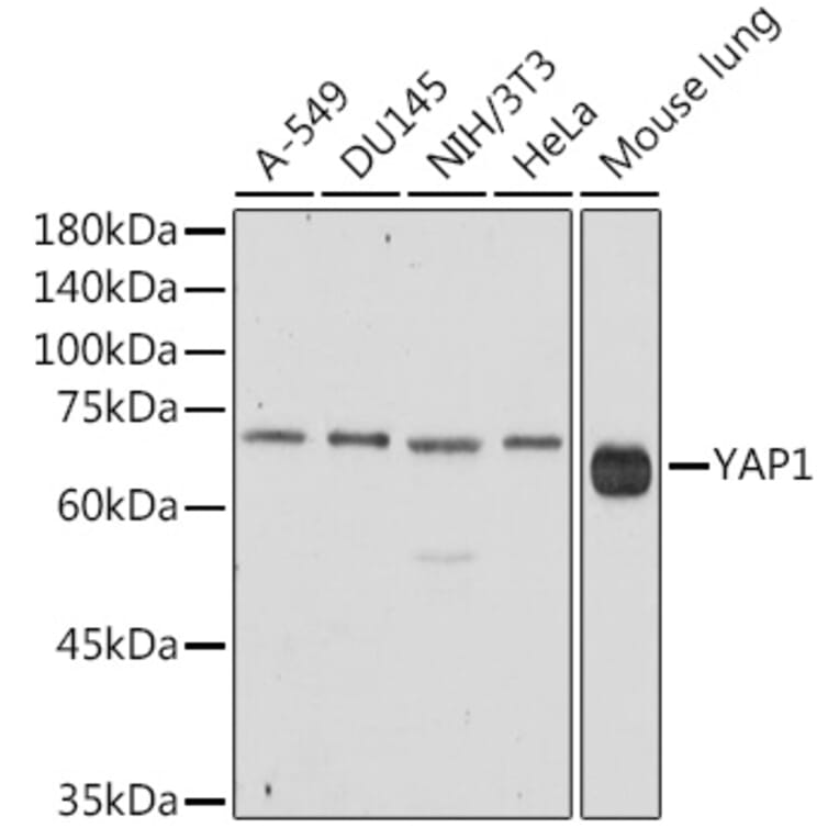 Western Blot - Anti-YAP1 Antibody (A93149) - Antibodies.com