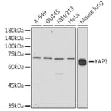 Western Blot - Anti-YAP1 Antibody (A93149) - Antibodies.com