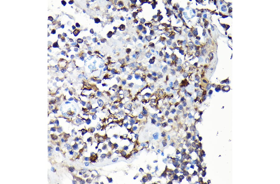 Immunohistochemistry - Anti-YAP1 Antibody (A93149) - Antibodies.com