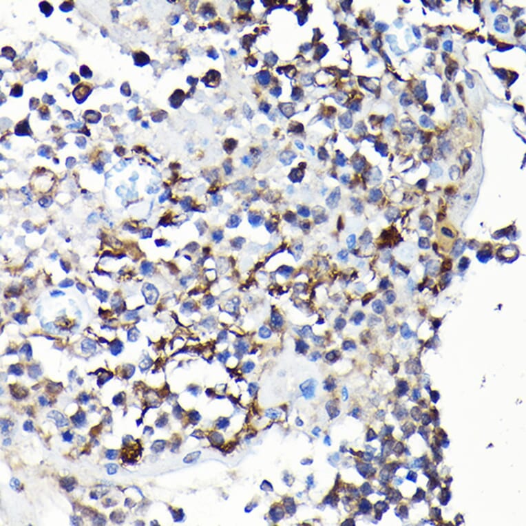 Immunohistochemistry - Anti-YAP1 Antibody (A93149) - Antibodies.com