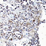 Immunohistochemistry - Anti-YAP1 Antibody (A93149) - Antibodies.com