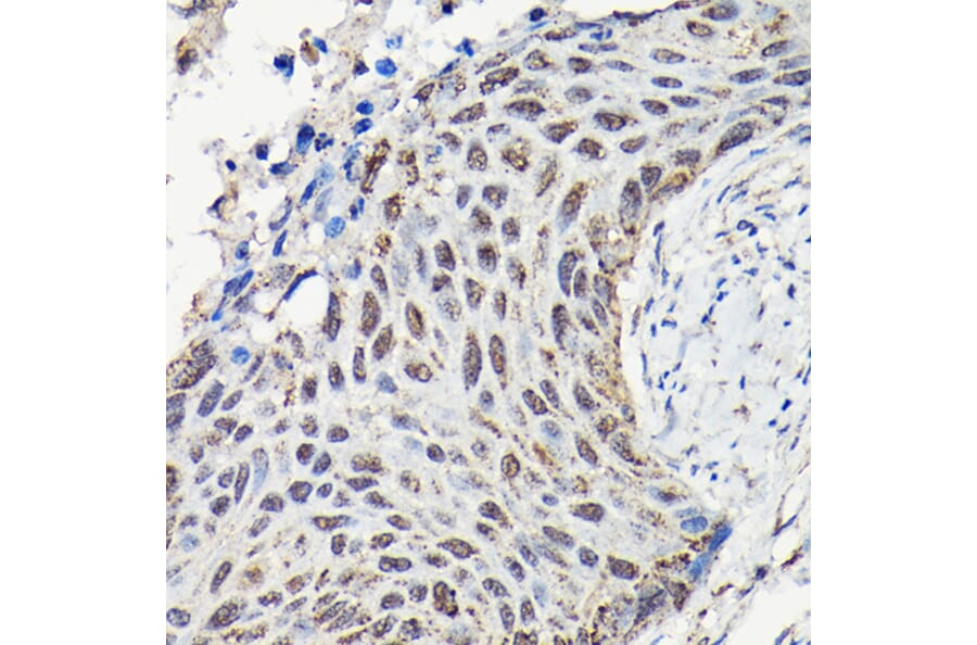 Immunohistochemistry - Anti-YAP1 Antibody (A93149) - Antibodies.com