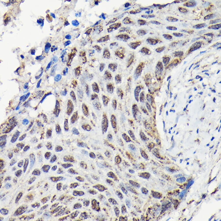 Immunohistochemistry - Anti-YAP1 Antibody (A93149) - Antibodies.com