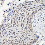 Immunohistochemistry - Anti-YAP1 Antibody (A93149) - Antibodies.com