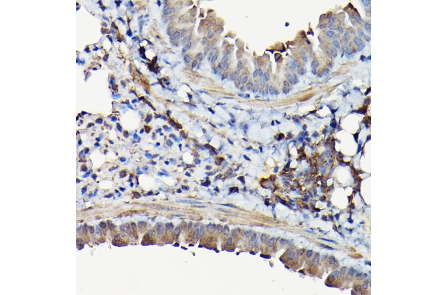 Immunohistochemistry - Anti-YAP1 Antibody (A93149) - Antibodies.com