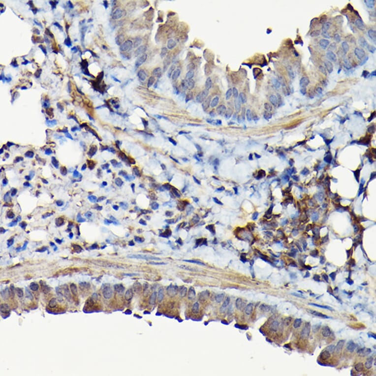 Immunohistochemistry - Anti-YAP1 Antibody (A93149) - Antibodies.com