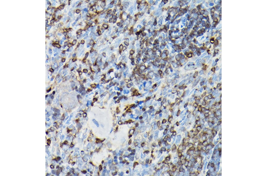 Immunohistochemistry - Anti-YAP1 Antibody (A93149) - Antibodies.com
