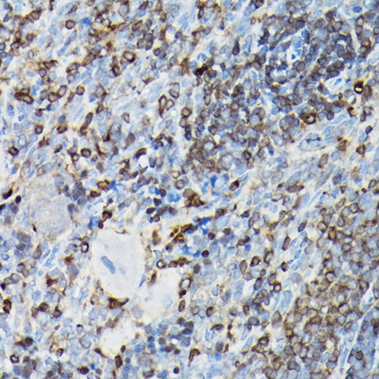 Immunohistochemistry - Anti-YAP1 Antibody (A93149) - Antibodies.com