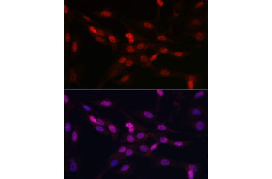 Immunofluorescence - Anti-YAP1 Antibody (A93149) - Antibodies.com