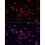 Immunofluorescence - Anti-YAP1 Antibody (A93149) - Antibodies.com