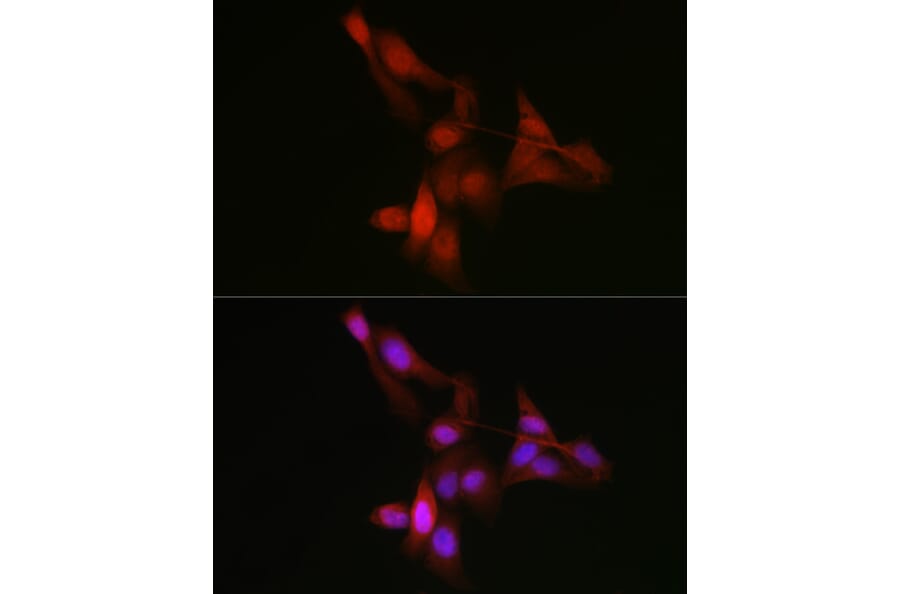 Immunofluorescence - Anti-YAP1 Antibody (A93149) - Antibodies.com