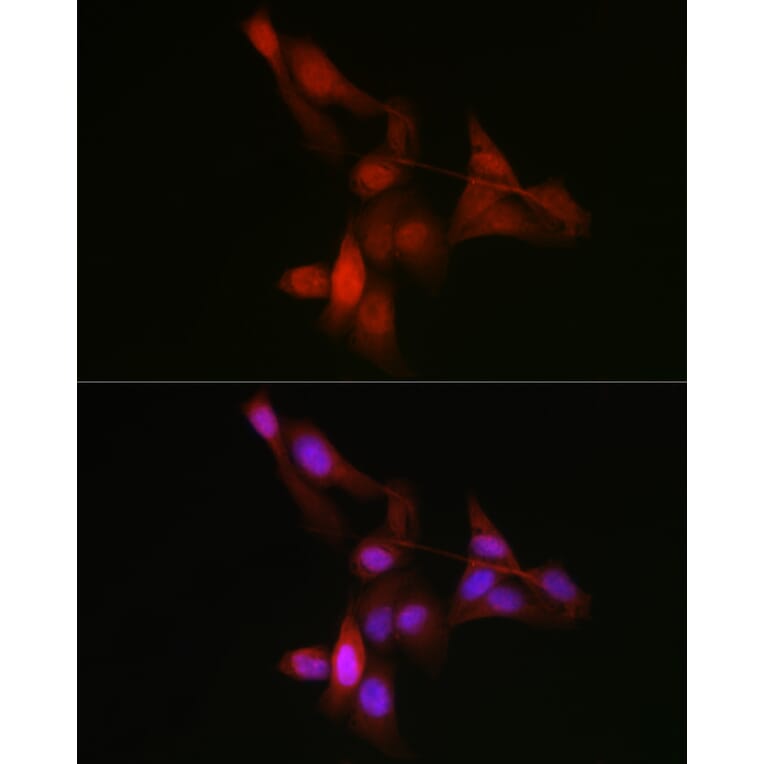 Immunofluorescence - Anti-YAP1 Antibody (A93149) - Antibodies.com