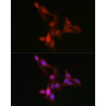 Immunofluorescence - Anti-YAP1 Antibody (A93149) - Antibodies.com