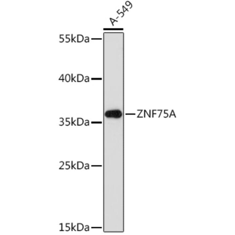 Western Blot - Anti-ZNF75A Antibody (A93150) - Antibodies.com