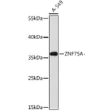 Western Blot - Anti-ZNF75A Antibody (A93150) - Antibodies.com
