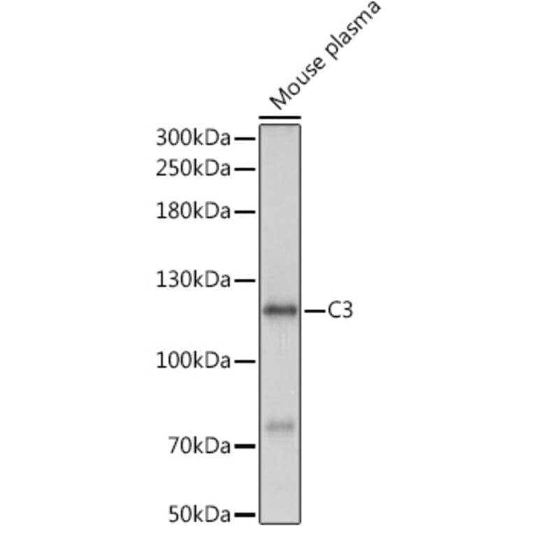 Western Blot - Anti-C3 Antibody (A93154) - Antibodies.com