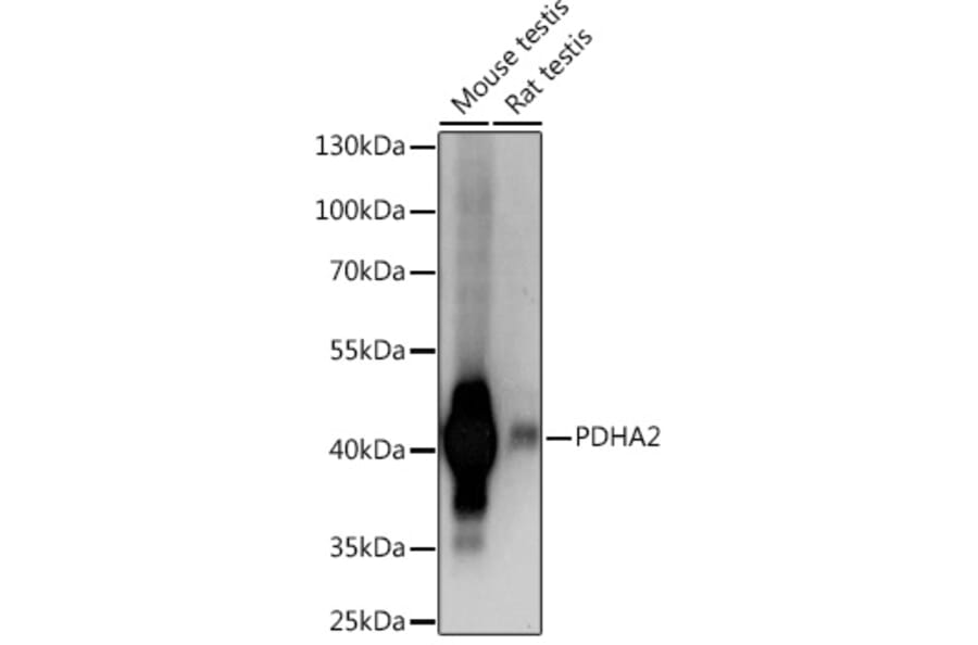 Western Blot - Anti-Pdha2 Antibody (A93155) - Antibodies.com