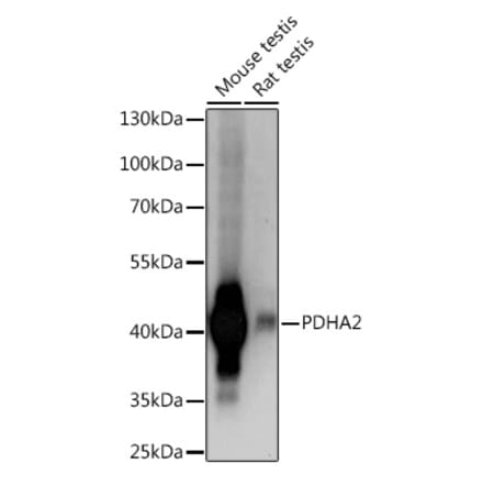 Western Blot - Anti-Pdha2 Antibody (A93155) - Antibodies.com