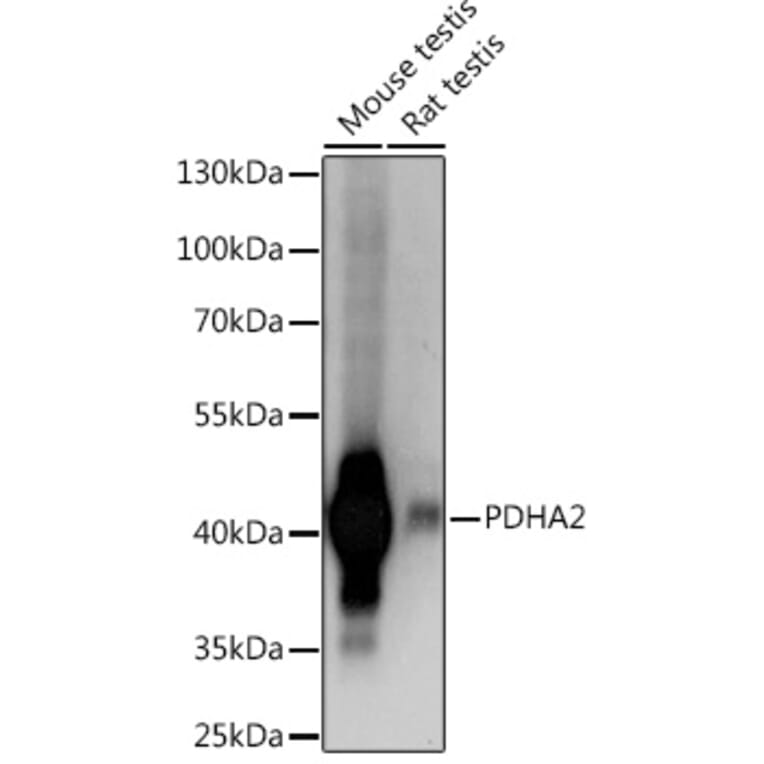 Western Blot - Anti-Pdha2 Antibody (A93155) - Antibodies.com