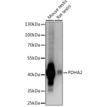 Western Blot - Anti-Pdha2 Antibody (A93155) - Antibodies.com