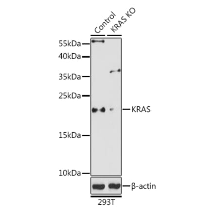 Western Blot - Anti-KRAS Antibody (A93164) - Antibodies.com